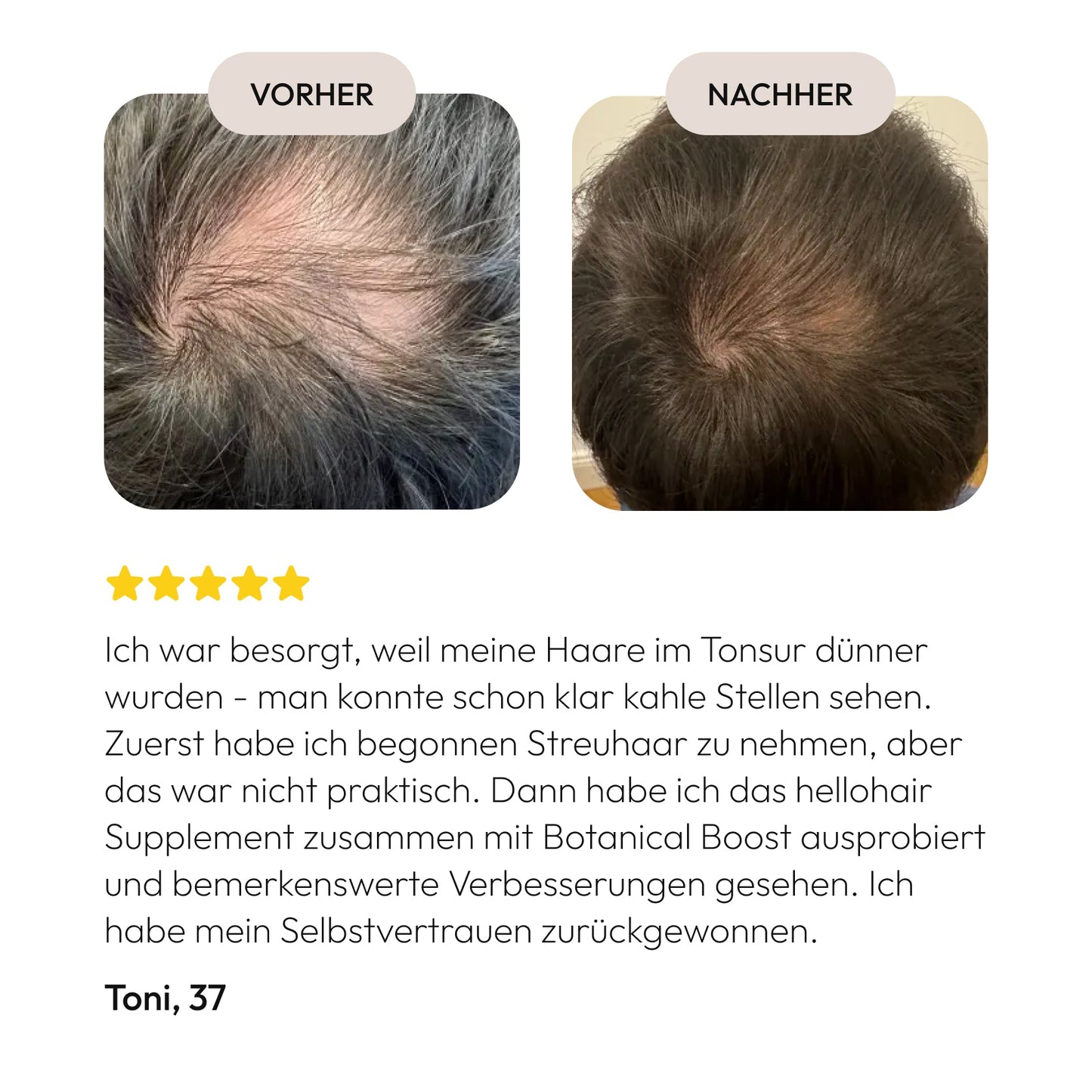 BOTANICAL BOOST