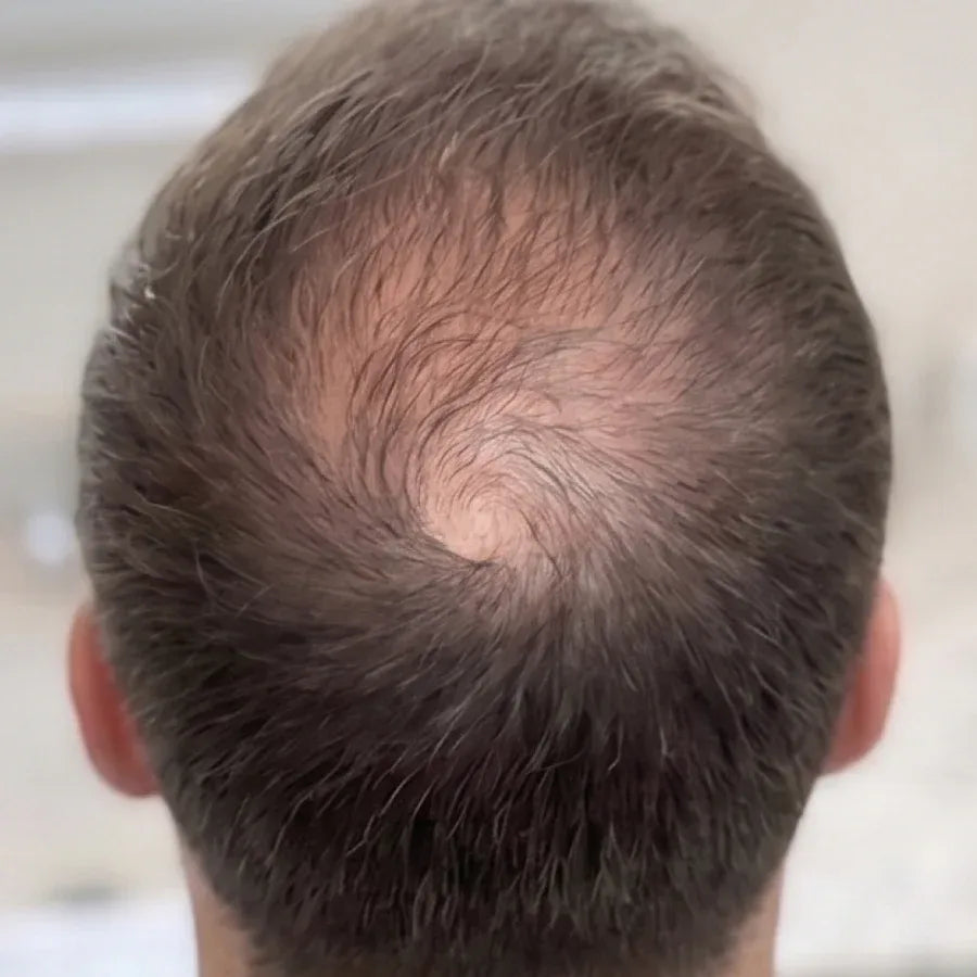 Monat 1