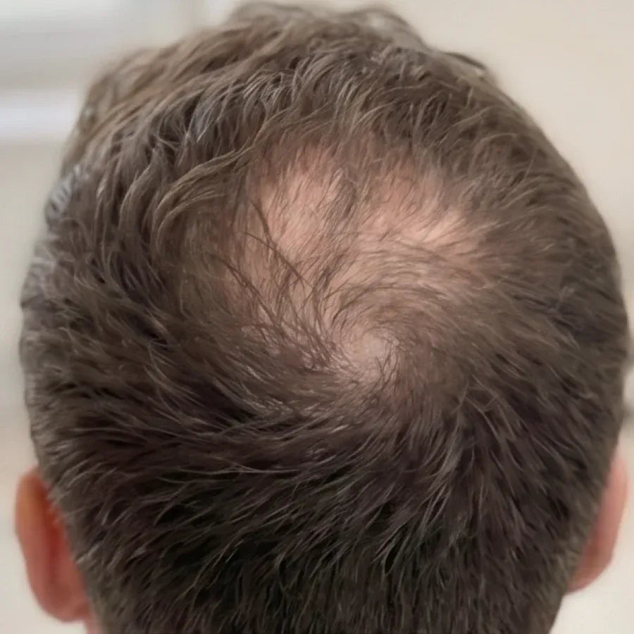 Monat 3